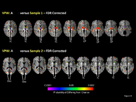 A series of brain scan images displaying two comparisons, labeled 