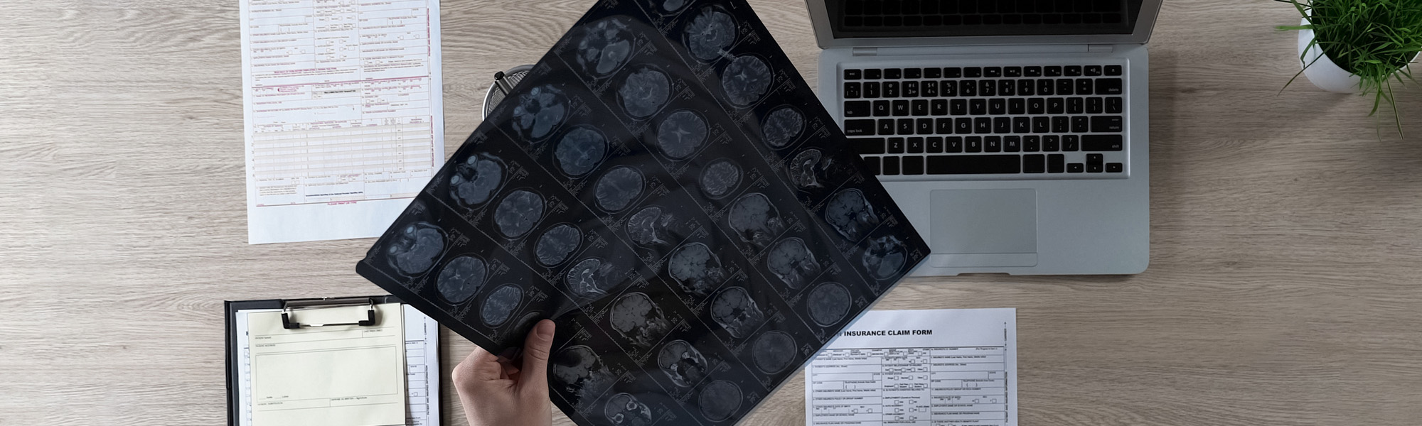 A person holds brain scan images above a desk with a laptop, insurance claim forms, and a clipboard. A small plant is at the corner of the desk.